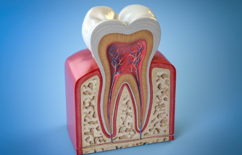 Root Canal Therapy